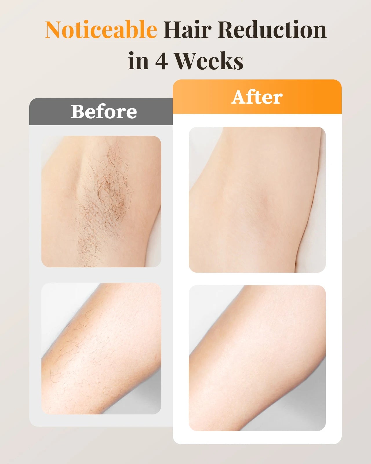 Professional IPL Laser Hair Removal For Women and Men,Ice-Cooling Painless ElectricDepilator,  Body Bikinis Permanent Depilation